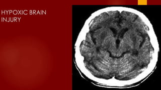 Case review ct mri brain part 4 dr ahmed esawy