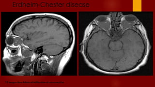 Case review ct  mri brain part 6 dr ahmed esawy
