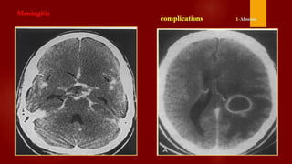 Case review ct  mri brain part 7 dr ahmed esawy