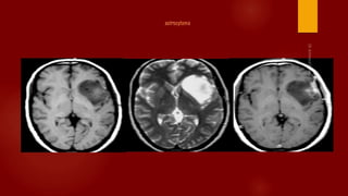 Case review ct mri brain part 1 dr ahmed esawy