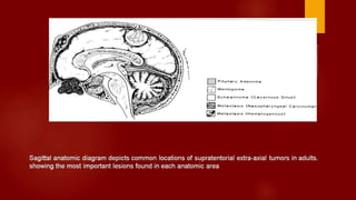 Case review ct mri brain part 1 dr ahmed esawy