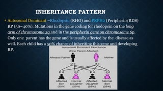 Rp Inheritance Pattern a diagnosed case of Retinitis Pigmentosa .pptx