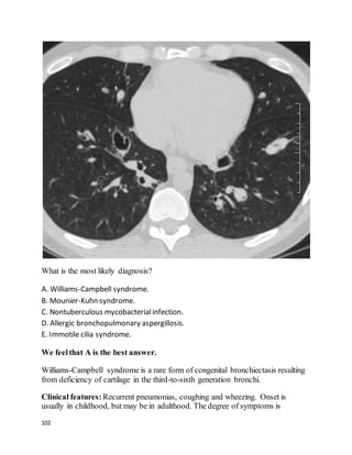 102
What is the most likely diagnosis?
A. Williams-Campbell syndrome.
B. Mounier-Kuhn syndrome.
C. Nontuberculous mycobacterialinfection.
D. Allergic bronchopulmonary aspergillosis.
E. Immotile cilia syndrome.
We feelthat A is the best answer.
Williams-Campbell syndrome is a rare form of congenital bronchiectasis resulting
from deficiency of cartilage in the third-to-sixth generation bronchi.
Clinical features: Recurrent pneumonias, coughing and wheezing. Onset is
usually in childhood, but may be in adulthood. The degree of symptoms is
 