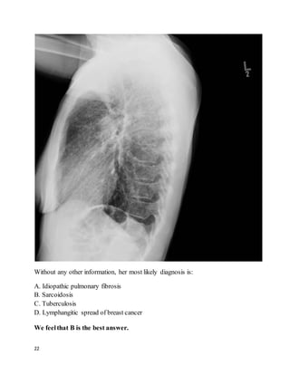 22
Without any other information, her most likely diagnosis is:
A. Idiopathic pulmonary fibrosis
B. Sarcoidosis
C. Tuberculosis
D. Lymphangitic spread of breast cancer
We feelthat B is the best answer.
 