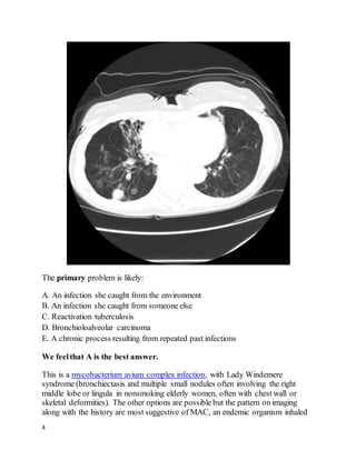 4
The primary problem is likely:
A. An infection she caught from the environment
B. An infection she caught from someone else
C. Reactivation tuberculosis
D. Bronchioloalveolar carcinoma
E. A chronic process resulting from repeated past infections
We feelthat A is the best answer.
This is a mycobacterium avium complex infection, with Lady Windemere
syndrome (bronchiectasis and multiple small nodules often involving the right
middle lobe or lingula in nonsmoking elderly women, often with chest wall or
skeletal deformities). The other options are possible but the pattern on imaging
along with the history are most suggestive of MAC, an endemic organism inhaled
 