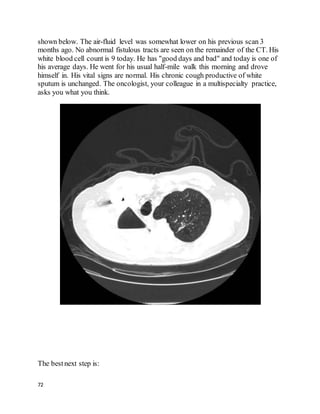 72
shown below. The air-fluid level was somewhat lower on his previous scan 3
months ago. No abnormal fistulous tracts are seen on the remainder of the CT. His
white blood cell count is 9 today. He has "good days and bad" and today is one of
his average days. He went for his usual half-mile walk this morning and drove
himself in. His vital signs are normal. His chronic cough productive of white
sputum is unchanged. The oncologist, your colleague in a multispecialty practice,
asks you what you think.
The bestnext step is:
 