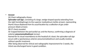 Spinacker Sign cases of neonatal atlas pediatric. .pptx