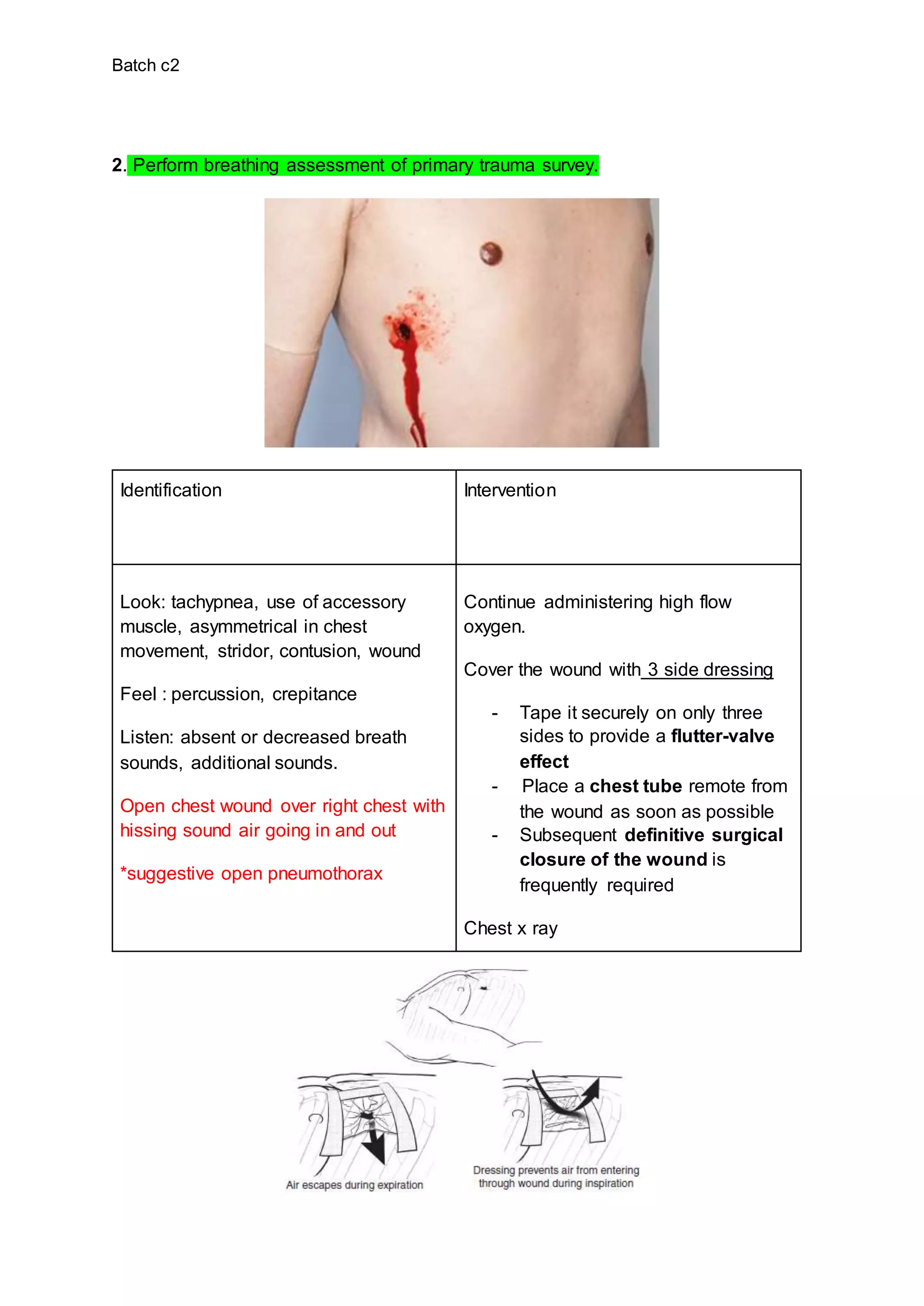 Batch c2
2. Perform breathing assessment of primary trauma survey.
Identification Intervention
Look: tachypnea, use of accessory
muscle, asymmetrical in chest
movement, stridor, contusion, wound
Feel : percussion, crepitance
Listen: absent or decreased breath
sounds, additional sounds.
Open chest wound over right chest with
hissing sound air going in and out
*suggestive open pneumothorax
Continue administering high flow
oxygen.
Cover the wound with 3 side dressing
- Tape it securely on only three
sides to provide a flutter-valve
effect
- Place a chest tube remote from
the wound as soon as possible
- Subsequent definitive surgical
closure of the wound is
frequently required
Chest x ray
 