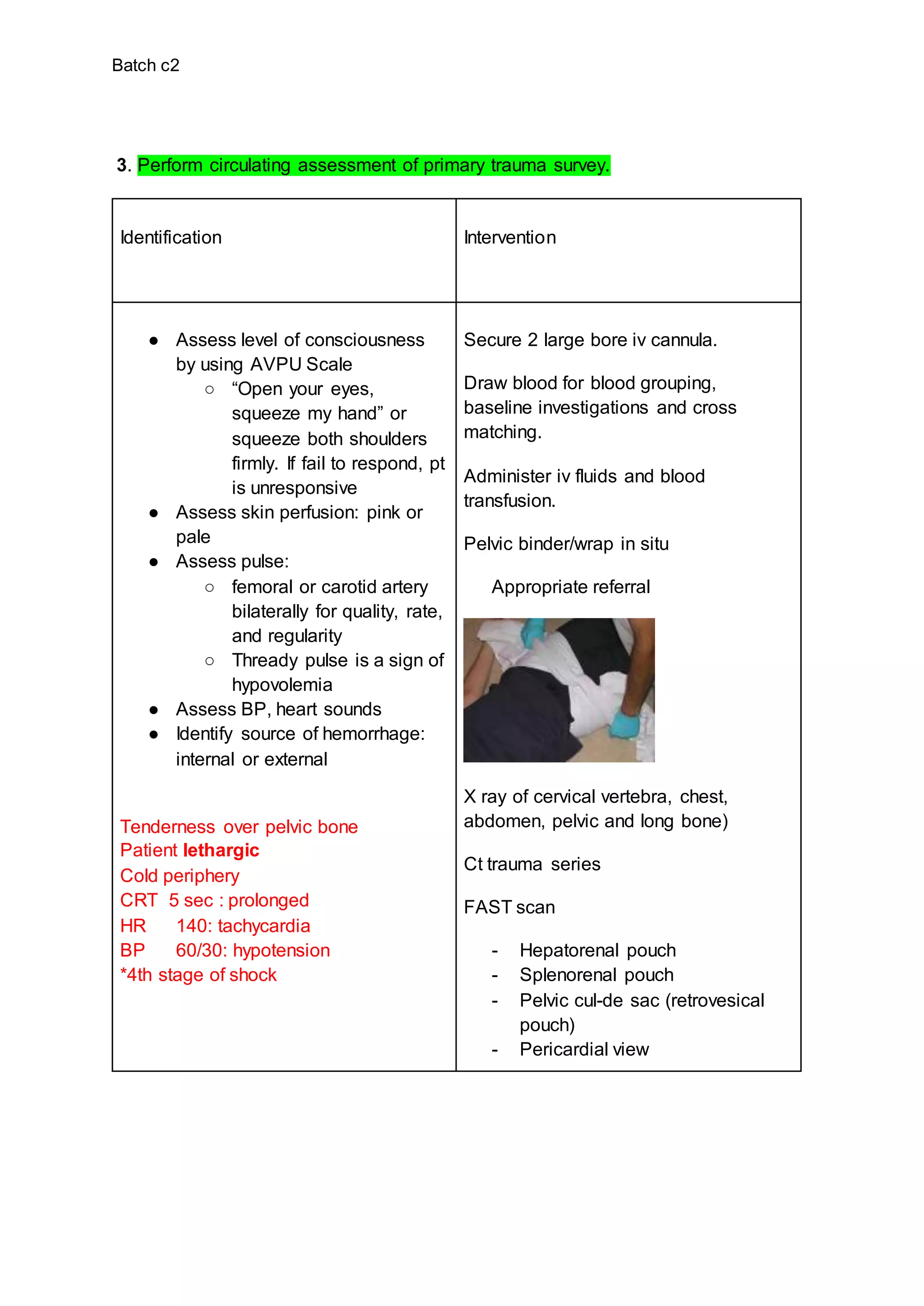 Batch c2
3. Perform circulating assessment of primary trauma survey.
Identification Intervention
● Assess level of consciousness
by using AVPU Scale
○ “Open your eyes,
squeeze my hand” or
squeeze both shoulders
firmly. If fail to respond, pt
is unresponsive
● Assess skin perfusion: pink or
pale
● Assess pulse:
○ femoral or carotid artery
bilaterally for quality, rate,
and regularity
○ Thready pulse is a sign of
hypovolemia
● Assess BP, heart sounds
● Identify source of hemorrhage:
internal or external
Tenderness over pelvic bone
Patient lethargic
Cold periphery
CRT 5 sec : prolonged
HR 140: tachycardia
BP 60/30: hypotension
*4th stage of shock
Secure 2 large bore iv cannula.
Draw blood for blood grouping,
baseline investigations and cross
matching.
Administer iv fluids and blood
transfusion.
Pelvic binder/wrap in situ
Appropriate referral
X ray of cervical vertebra, chest,
abdomen, pelvic and long bone)
Ct trauma series
FAST scan
- Hepatorenal pouch
- Splenorenal pouch
- Pelvic cul-de sac (retrovesical
pouch)
- Pericardial view
 