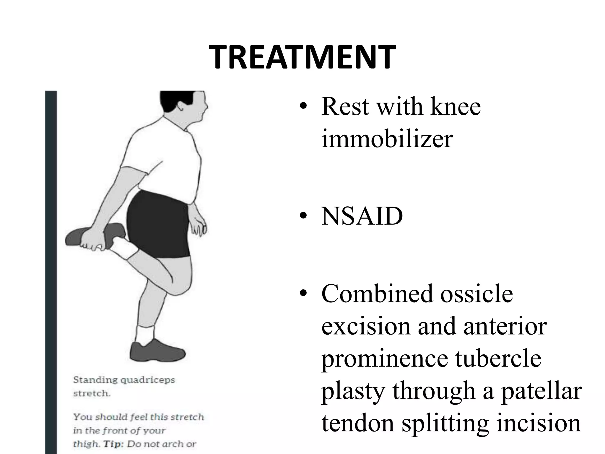 TREATMENT
• Rest with knee
immobilizer
• NSAID
• Combined ossicle
excision and anterior
prominence tubercle
plasty through a patellar
tendon splitting incision
 