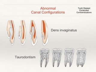 Tooth Related Contended 
Contraindications 
 