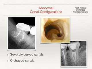 Abnormal 
Canal Configurations 
Tooth Related 
Contended 
Contraindications 
Taurodontism 
Dens invaginatus 
 