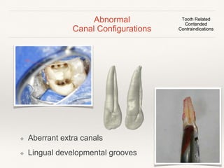 Abnormal 
Canal Configurations 
Tooth Related 
Contended 
Contraindications 
❖ Severely curved canals 
❖ C-shaped canals 
 