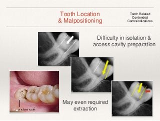 Tooth Location 
& Malpositioning 
Tooth Related 
Contended 
Contraindications 
Difficulty in isolation & 
access cavity preparation 
May even required 
extraction 
 