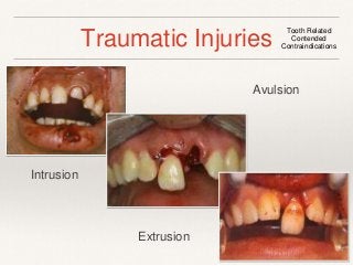 Traumatic Injuries Tooth Related 
Contended 
Contraindications 
Avulsion 
Extrusion 
Intrusion 
 