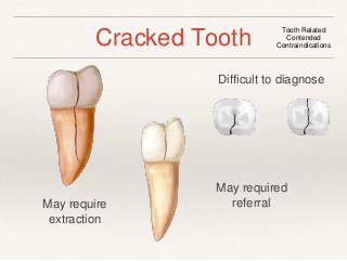 Cracked Tooth Tooth Related 
Contended 
Contraindications 
Difficult to diagnose 
May require 
extraction 
May required 
referral 
 