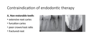 case selection and endodontic treatment.pptx