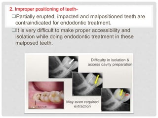 2. Improper positioning of teeth-
Partially erupted, impacted and malpositioned teeth are
contraindicated for endodontic treatment.
It is very difficult to make proper accessibility and
isolation while doing endodontic treatment in these
malposed teeth.
 