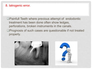 8. Iatrogenic error.
Painfull Teeth where previous attempt of endodontic
treatment has been done often show ledges,
perforations, broken instruments in the canals.
Prognosis of such cases are questionable if not treated
properly.
 