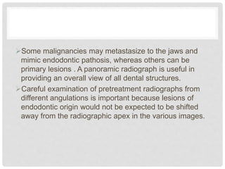 Some malignancies may metastasize to the jaws and
mimic endodontic pathosis, whereas others can be
primary lesions . A panoramic radiograph is useful in
providing an overall view of all dental structures.
Careful examination of pretreatment radiographs from
different angulations is important because lesions of
endodontic origin would not be expected to be shifted
away from the radiographic apex in the various images.
 