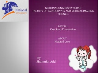 By:
Shumukh Adel
BATCH 11
Case Study Presentation
NATIONAL UNIVERSITY SUDAN
FACULTY OF RADIOGRAPHY AND MEDICAL IMAGING
SCIENCE.
ABOUT
Hydatid Cysts
 