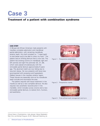 Cases in Prosthodontics - Wiley-Blackwell; 1 edition (October 26, 2010).pdf