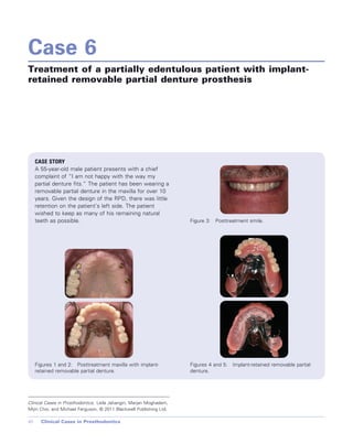 Cases in Prosthodontics - Wiley-Blackwell; 1 edition (October 26, 2010).pdf
