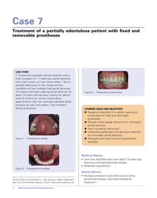 Cases in Prosthodontics - Wiley-Blackwell; 1 edition (October 26, 2010).pdf