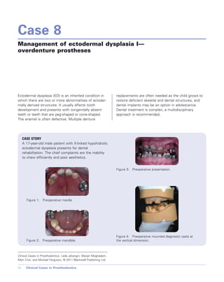 Cases in Prosthodontics - Wiley-Blackwell; 1 edition (October 26, 2010).pdf