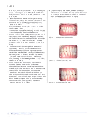 Cases in Prosthodontics - Wiley-Blackwell; 1 edition (October 26, 2010).pdf