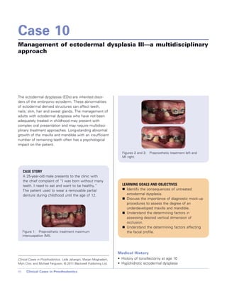 Cases in Prosthodontics - Wiley-Blackwell; 1 edition (October 26, 2010).pdf