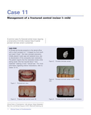 Cases in Prosthodontics - Wiley-Blackwell; 1 edition (October 26, 2010).pdf