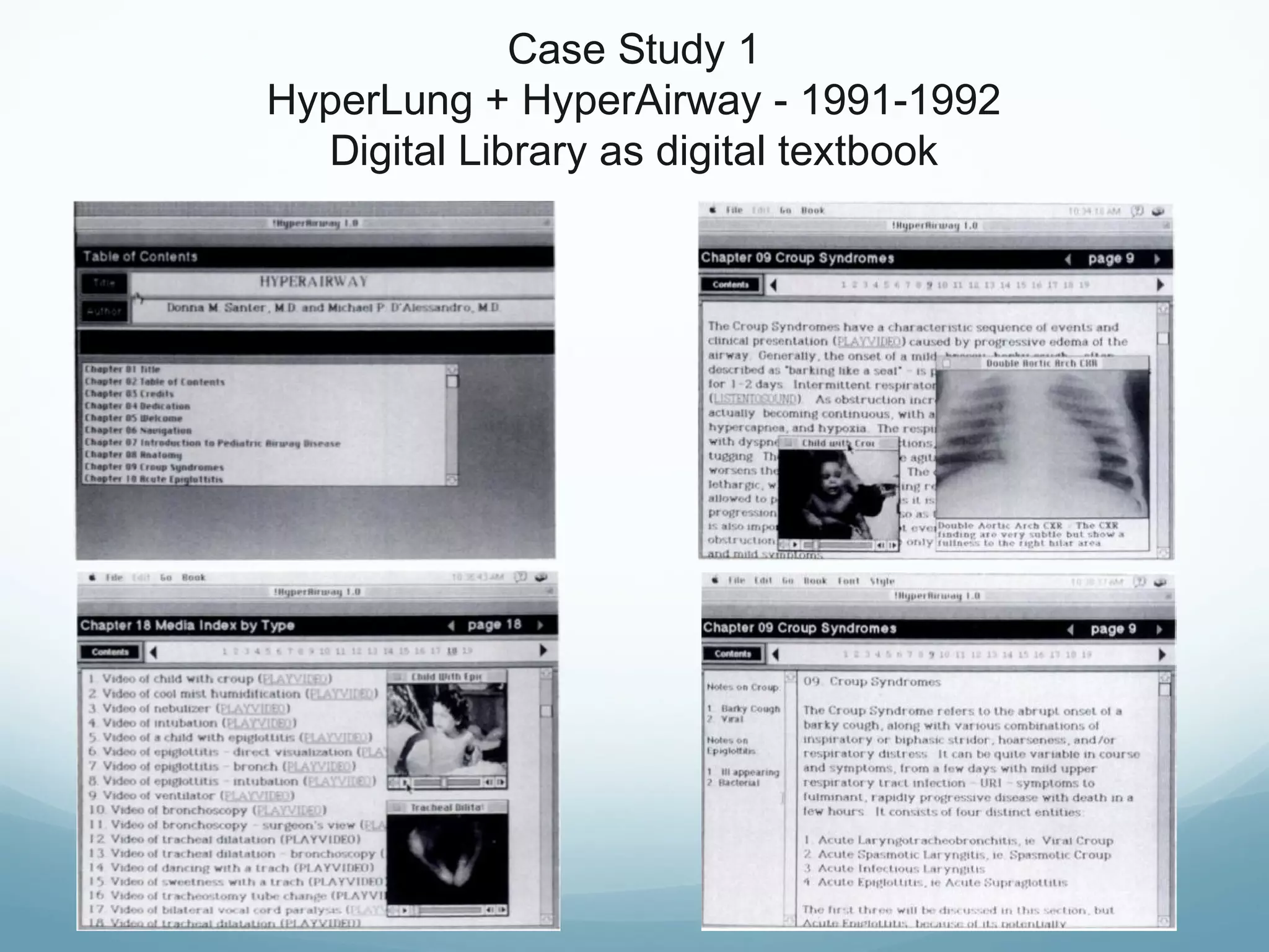 Case Study 1
HyperLung + HyperAirway - 1991-1992
Digital Library as digital textbook
 