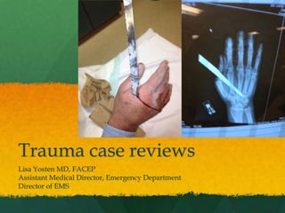 Trauma case reviews
Lisa Yosten MD, FACEP
Assistant Medical Director, Emergency Department
Director of EMS
 