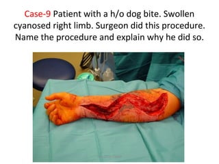 Case-9 Patient with a h/o dog bite. Swollen
cyanosed right limb. Surgeon did this procedure.
Name the procedure and explain why he did so.
Dec-2016-CSBRP
 