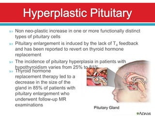    Non neo-plastic increase in one or more functionally distinct
    types of pituitary cells
   Pituitary enlargement is induced by the lack of T4 feedback
    and has been reported to revert on thyroid hormone
    replacement
   The incidence of pituitary hyperplasia in patients with
    hypothyroidism varies from 25% to 81%
   Thyroid hormone
    replacement therapy led to a
    decrease in the size of the
    gland in 85% of patients with
    pituitary enlargement who
    underwent follow-up MR
    examinations
                                          Pituitary Gland
 