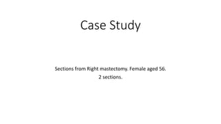 Case Study
Sections from Right mastectomy. Female aged 56.
2 sections.
 