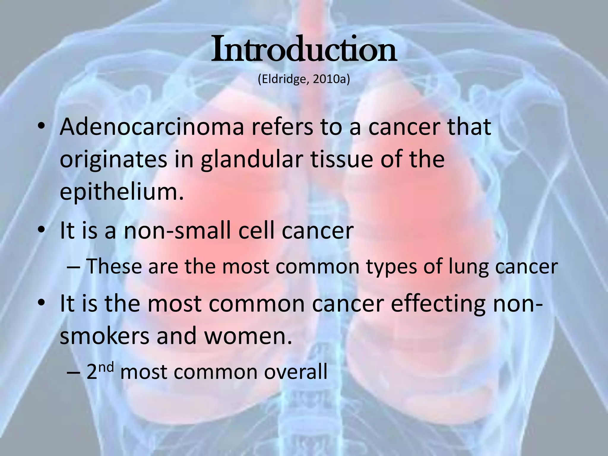 Case study adenocarcinoma of the lung | PPTX