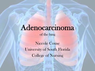 Adenocarcinoma
of the lung
Niccole Couse
University of South Florida
College of Nursing
 