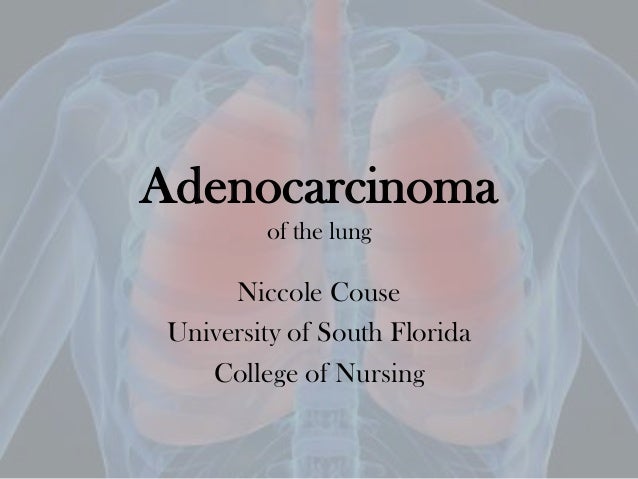 nursing case study lung cancer nursing case study lung cancer