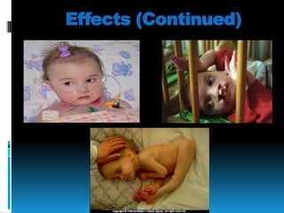Effects (Continued)

 