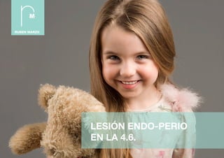 LESIÓN ENDO-PERIO
EN LA 4.6.
 