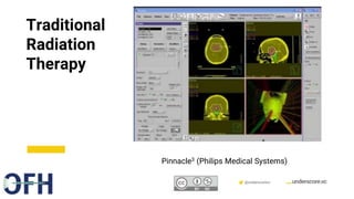 Confidential & Proprietary @underscorevc
Traditional
Radiation
Therapy
Pinnacle3 (Philips Medical Systems)
 