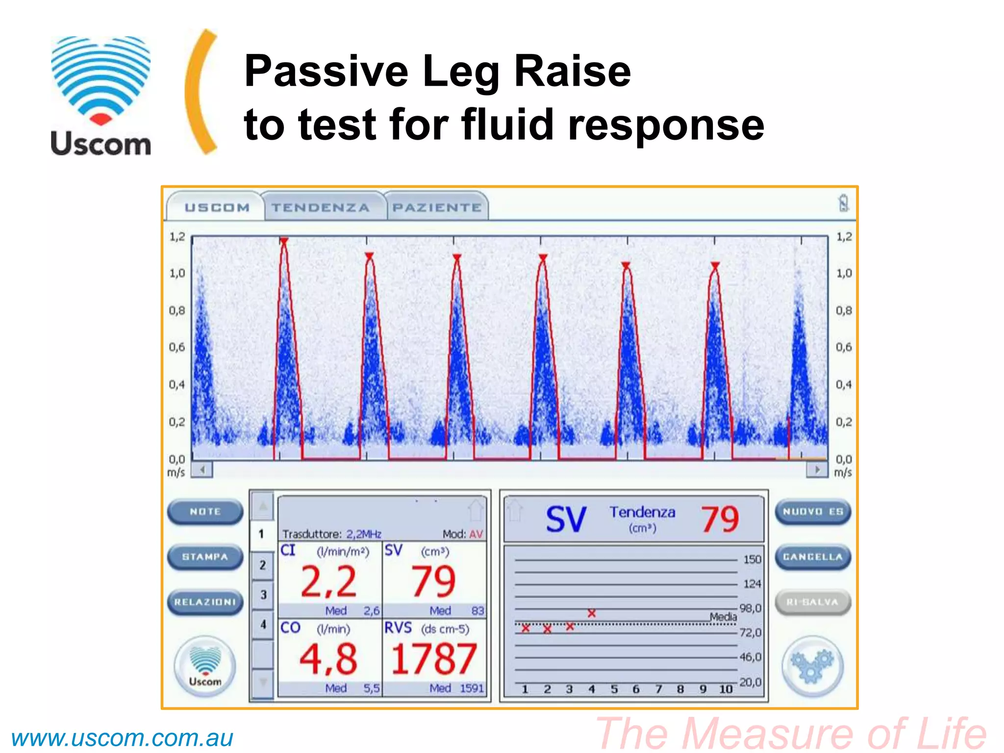 Case Study - Adult - Passive Leg Raise | PPT