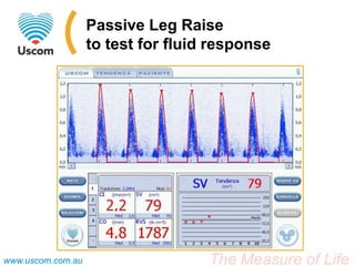 Passive Leg Raise
                   to test for fluid response




www.uscom.com.au                    The Measure of Life
 