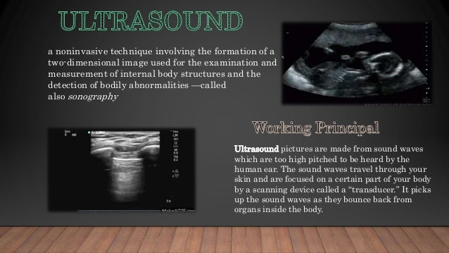 Baby h case study picture