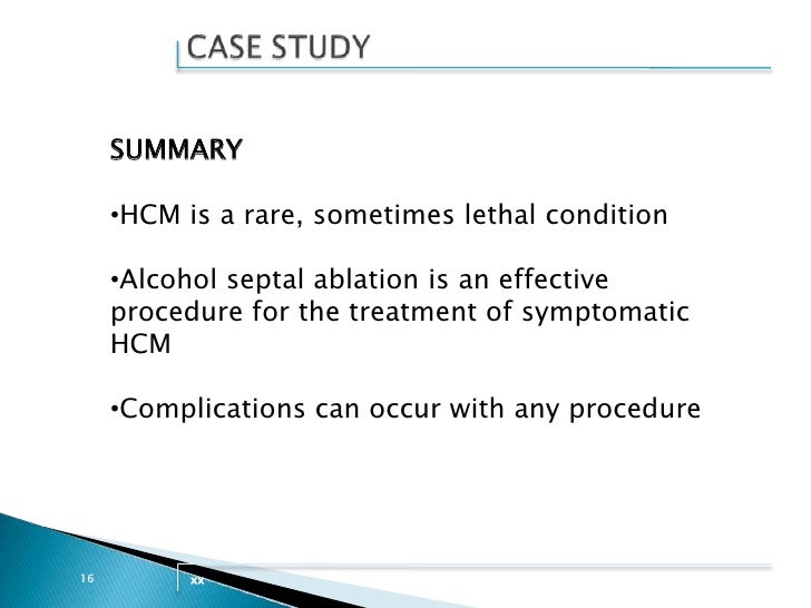 Hypertrophic cardiomyopathy ecg image