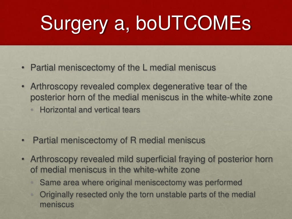 Pain from torn meniscus suddenly disappeared image