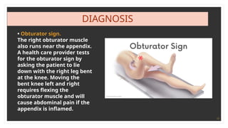 13
DIAGNOSIS
• Obturator sign.
The right obturator muscle
also runs near the appendix.
A health care provider tests
for the obturator sign by
asking the patient to lie
down with the right leg bent
at the knee. Moving the
bent knee left and right
requires flexing the
obturator muscle and will
cause abdominal pain if the
appendix is inflamed.
 