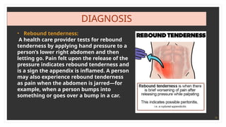 16
DIAGNOSIS
• Rebound tenderness:
A health care provider tests for rebound
tenderness by applying hand pressure to a
person’s lower right abdomen and then
letting go. Pain felt upon the release of the
pressure indicates rebound tenderness and
is a sign the appendix is inflamed. A person
may also experience rebound tenderness
as pain when the abdomen is jarred—for
example, when a person bumps into
something or goes over a bump in a car.
 